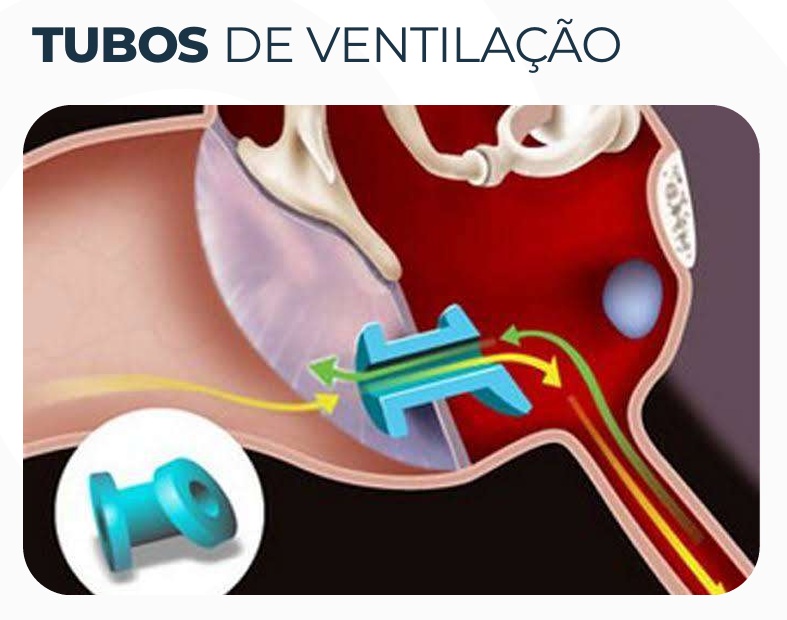 Tubos de ventilação